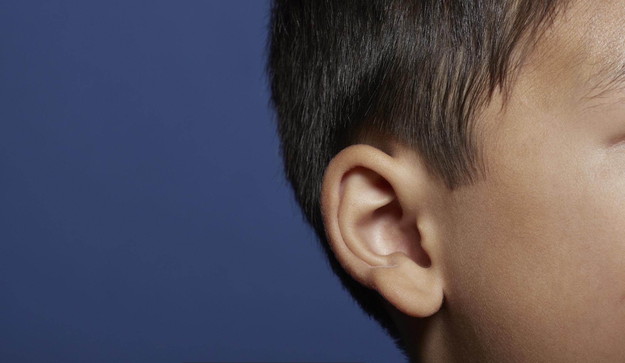 【案例分析】35岁男性患者做耳再造手术矫正小耳畸形 - 哔哩哔哩